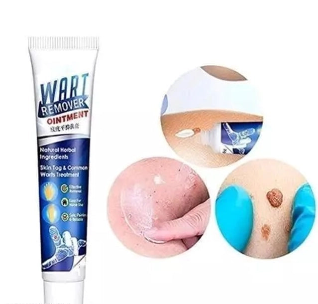 Wart Remover Cream (100 g)