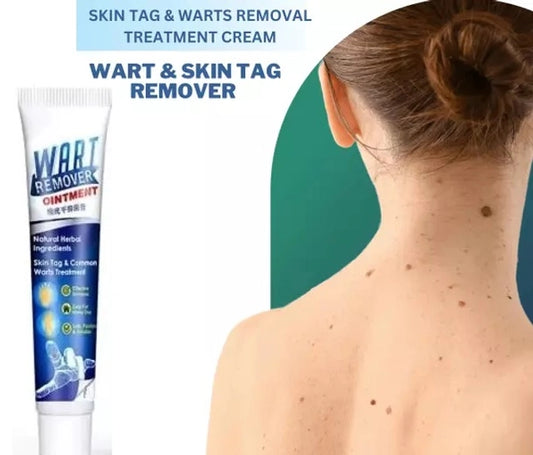 Wart Remover Cream (100 g)